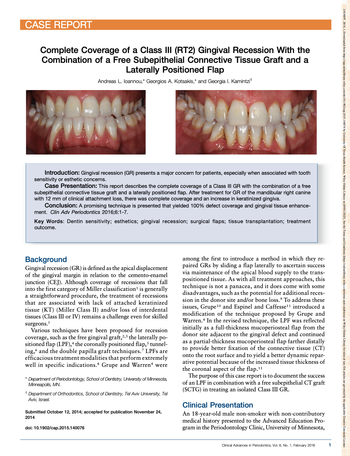 Article - Dr.Kotsakis - Lab